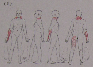 ストレッチクリニック 第8回-4-1