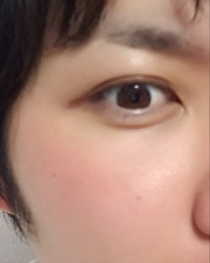 涙袋作っただけで超絶イケメン化したんだけどwwwwww えんとつ速報 えん速