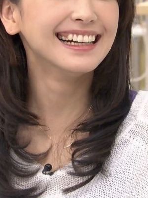 悲報 新垣結衣の歯 キモい