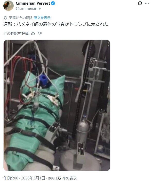 【※閲覧注意】ハメネイ師の遺体画像、ガチでヤバい…