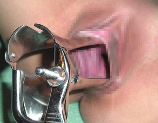 ●【画像】マンコ×クスコ・・・くぱぁで中まで丸見えｗｗｗ エログニュースJAPAN