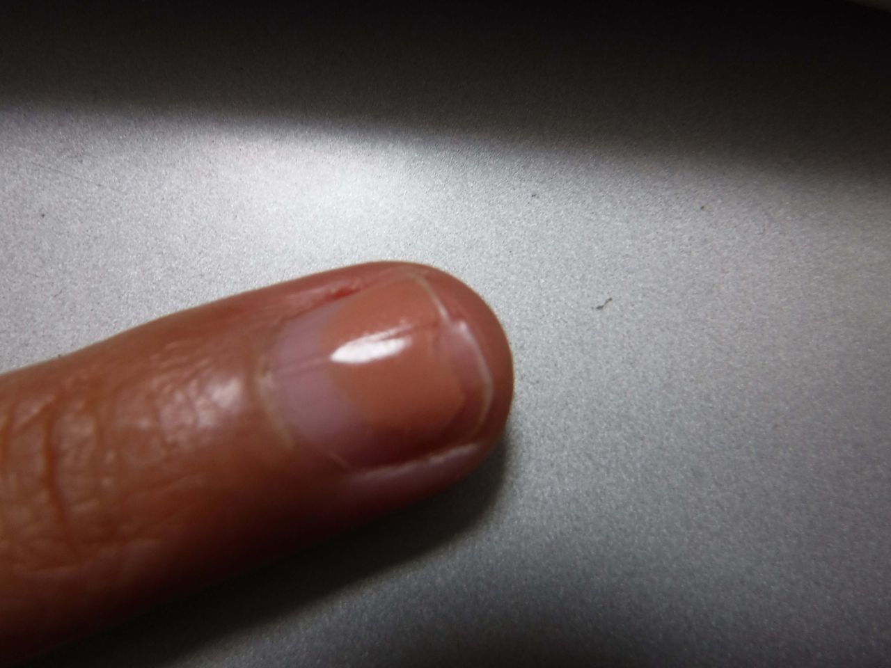 知らない間に爪に縦ジワ 爪の印象up ダメージのある爪 指先に潤いケア