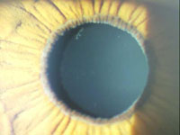 pe1