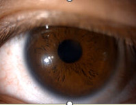 pupil2