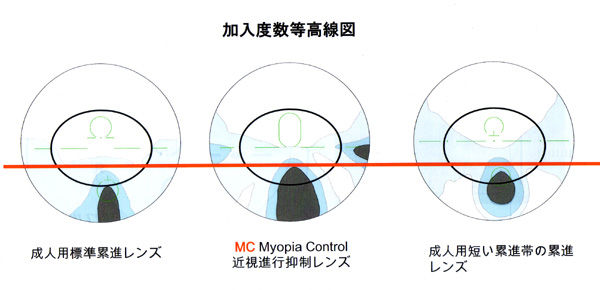 ある奈良県の眼科医が目について書いたブログ 目の病気 子供の目
