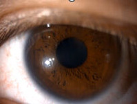 pupil