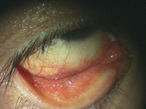ある奈良県の眼科医が目について書いたブログ 目の病気 花粉症 アレルギー性結膜炎