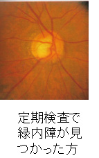 緑内障