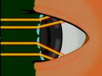 tear3