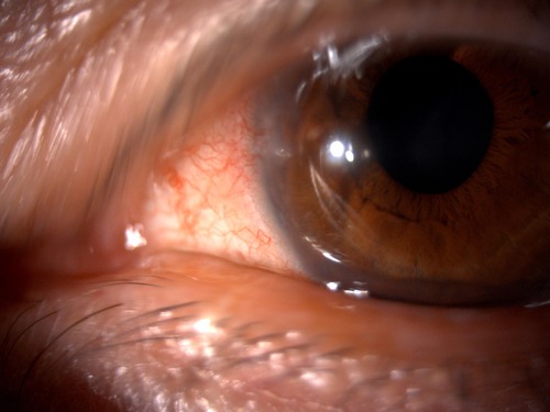 48158_20220329_090826_å_L_001