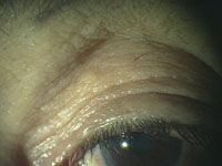 eye