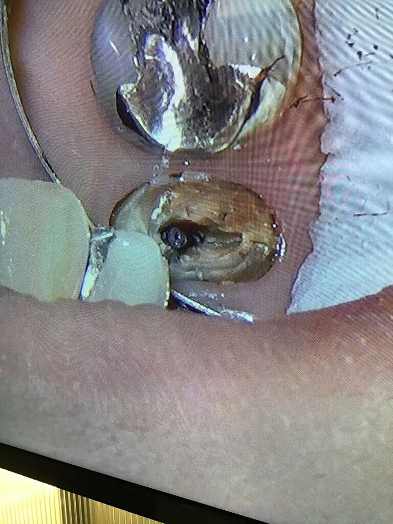 0A5268AA-70DE-45CC-9EE1-885A67FFE3EF