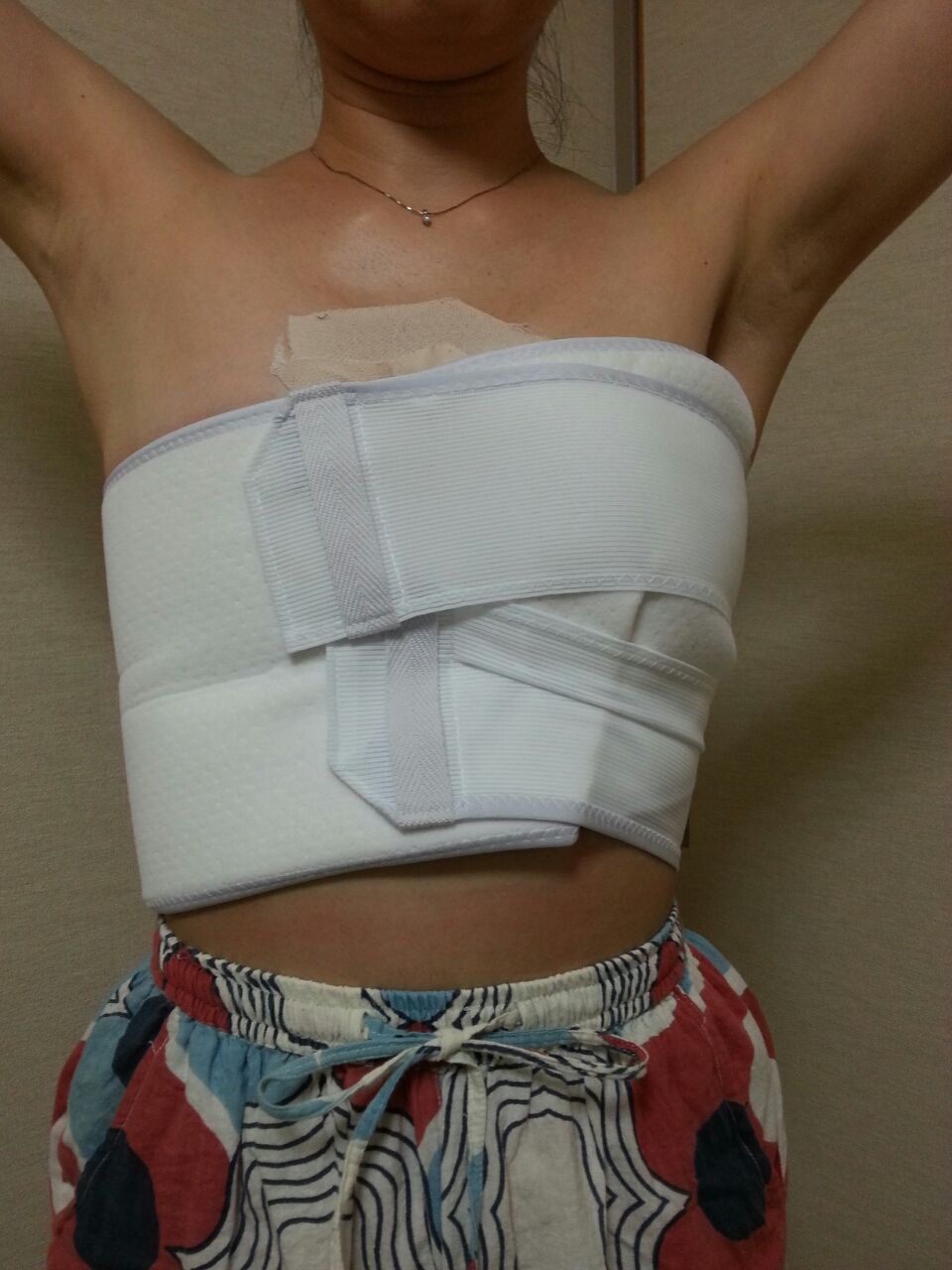 バンド 告白 乳ガン闘病日記