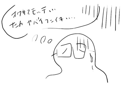 結石５