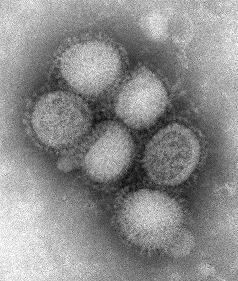 【画像あり】感染症マニアの俺が危険なウイルス・細菌・真菌・原虫を45種類紹介するよ！！！！！
