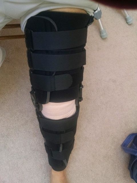 IMG_20170630_152736346