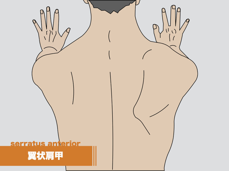 姿勢矯正士が教える！簡単ストレッチで痛みを解消しよう