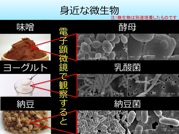 細菌吸血鬼症とは？身近な微生物に潜む驚きの能力とは？