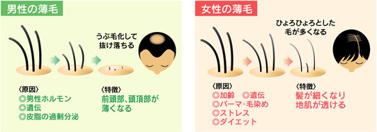 薄毛に悩むあなたへ。美容師推薦のボリュームアップシャンプー完全ガイド