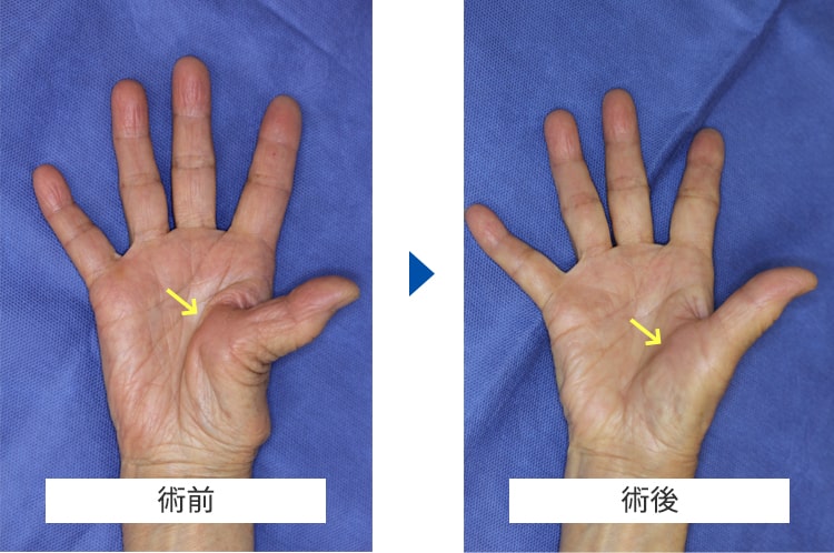 ブログで話題沸騰中！脚裏伸ばしダイエットの効果的な方法とは？