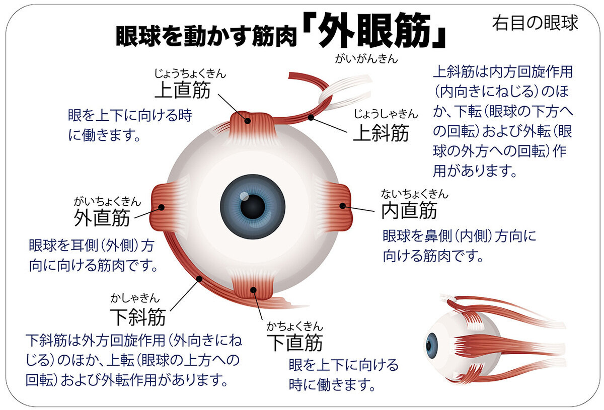隠れ斜視の真実：希少疾患を乗り越えた母と子の物語