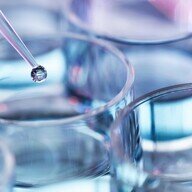 T細胞とは何か？免疫機能を持つ重要な細胞について解説。