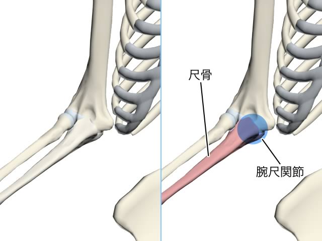 医療機器ニュース：肩・肘のリハビリを支援する上肢リハビリ装置が発売される