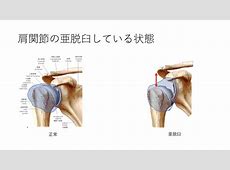 大谷翔平の怪我の真相：左肩亜脱臼の詳細と今後の出場への影響