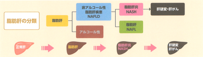 肝臓病革命：負担の少ない非アルコール性脂肪性肝炎の治療評価法