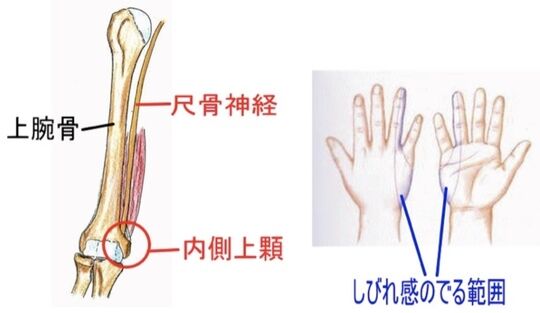 肘をぶつけるとなぜ電気が走るのか？驚きの身体の常識を解説！