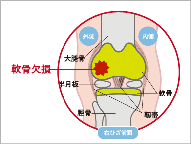 軟骨伝導イヤホンの魅力と実際の効果を探る