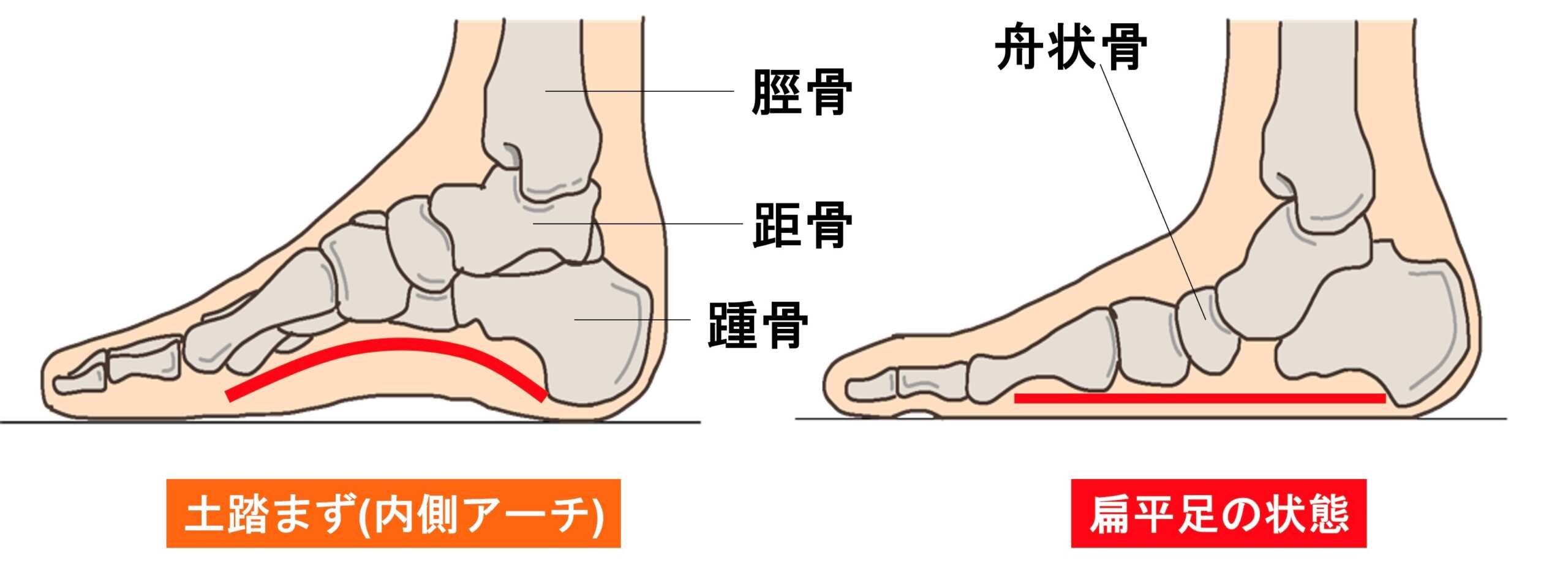ピラティスで実感した体の変化とおすすめケア法