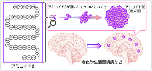 製薬株で注目のエーザイ！特許の崖を越える医薬品の可能性