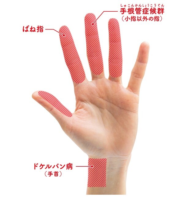 更年期の手指の痛みを軽減する3つのストレッチ法とは？