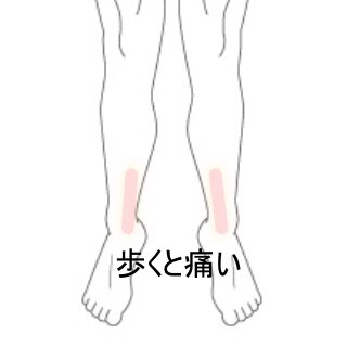 足の健康を守るためのトリセツ: NHKから学ぶポイント