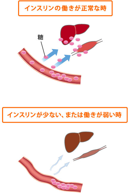 急性腎障害の最新研究とその影響：内科専門医試験を見据えて