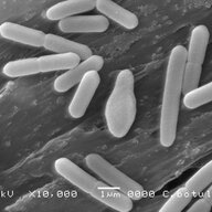 食中毒から身を守る！ボツリヌス菌の驚くべき実態とは