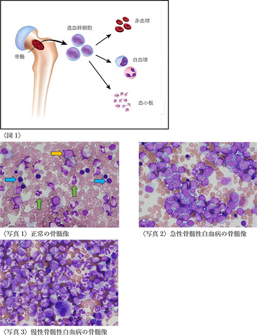 骨髄での造血を画像化できる革新的な技術が開発される