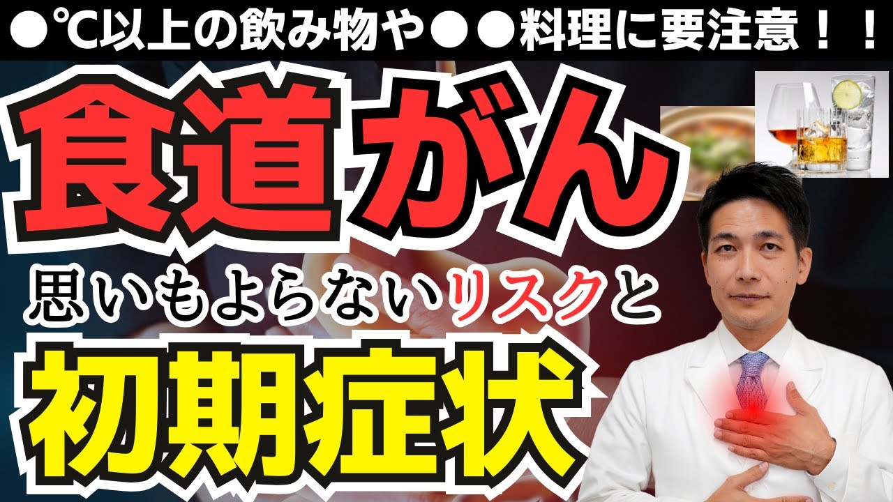 毎日の習慣が命を左右する？食道がんの実態と予防法