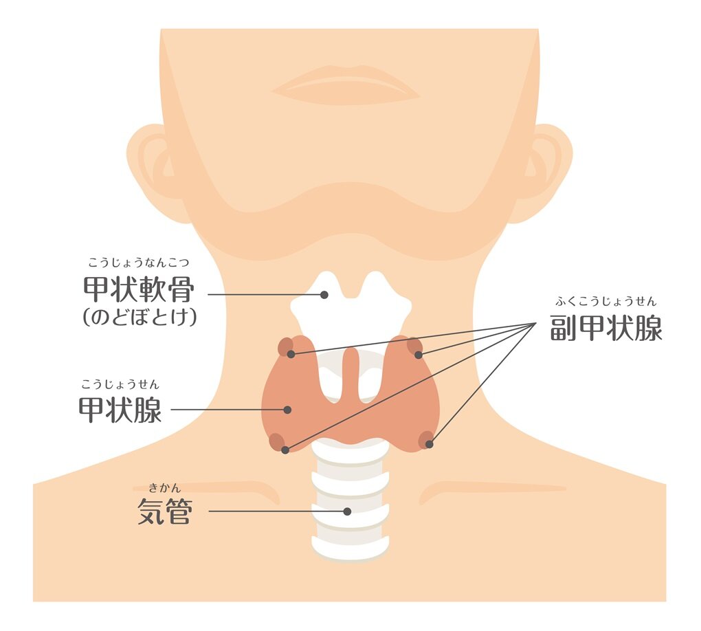 亜急性甲状腺炎の原因と症状：医師が教える、なりやすい人の特徴