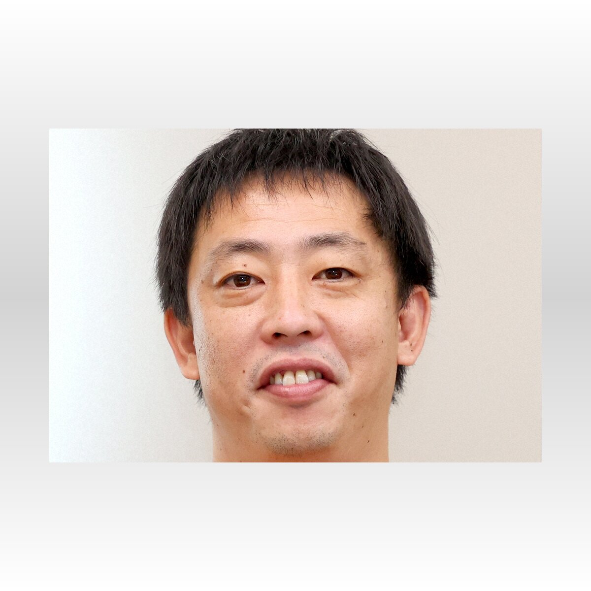 整形を選んだ理由とは？さらば森田の告白