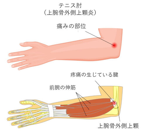 「初心者ランナー必見！オススメのストレッチ方法を紹介」