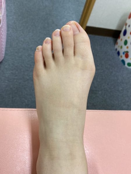 山本耕史、筋トレ中に足の指を骨折！家族の意外な反応とは？