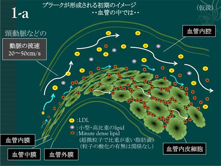 塩と血管健康：減塩神話の真実