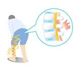 写真 腰痛? (150x131)