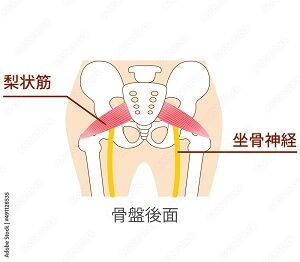 写真 腰痛 座骨神経 5 梨状筋! (300x262) に縮小