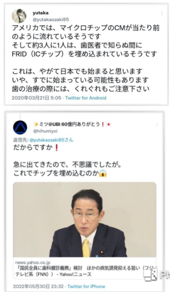 マイクロチップ