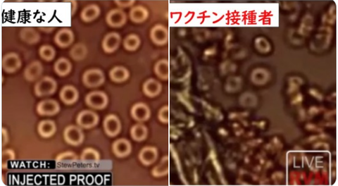 before after