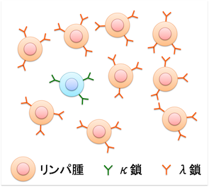 abnormalBcell.png