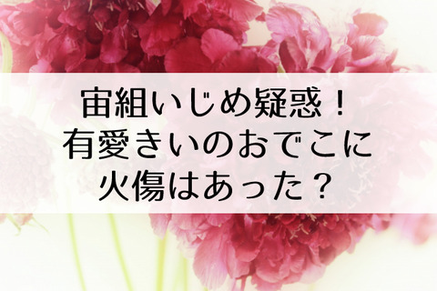 有愛きい火傷